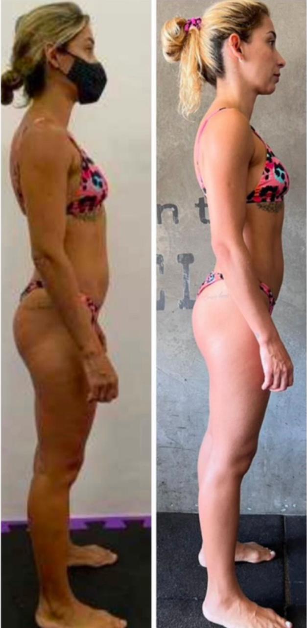 Antes e depois - Amanda Scarpa com recomposição corporal e definição feminina