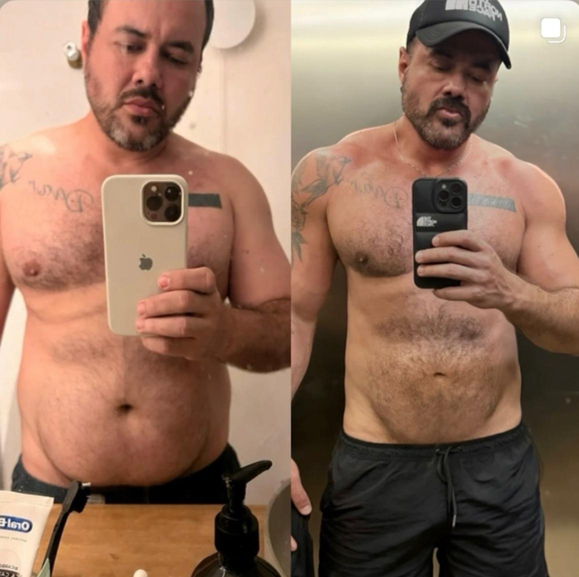 Antes e depois - José Henrique com redução de gordura abdominal e definição