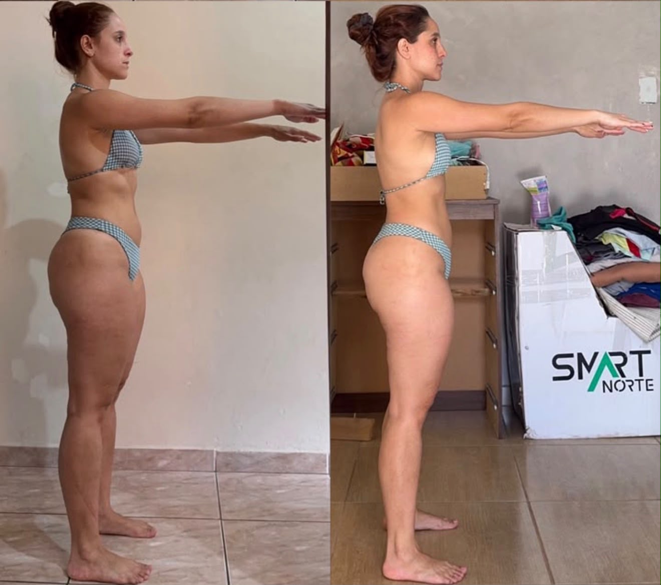 Antes e depois - Yasmin Garcia com alinhamento postural e redução de medidas